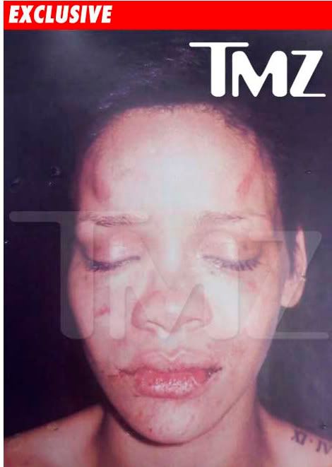 rihanna pictures after beating. rihanna pictures after beating