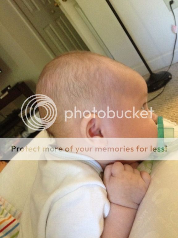 Thoughts? Is my baby's head flat? BabyCenter
