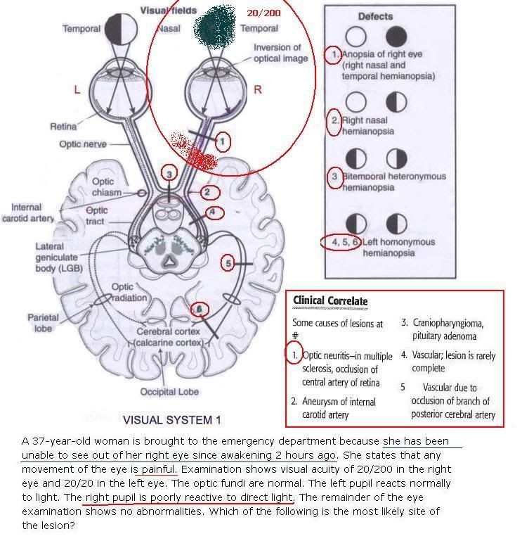 Comments on NB** F1 B1 : Q-2 Visual problems