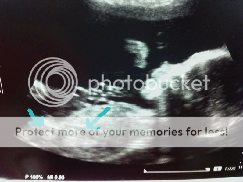 are those testicles in the abdomen?? BabyandBump