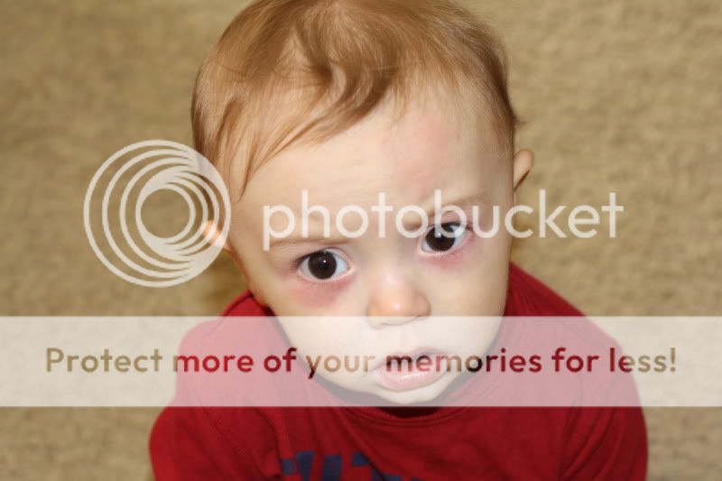 My sons eyes (PICS) BabyCenter